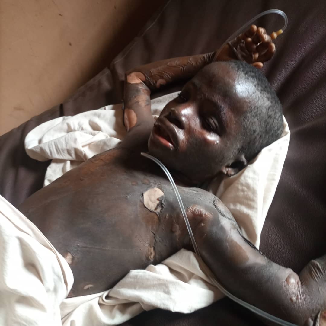 On the 20th of March 2022, officers from Ogun state police command arrested a housewife and mother of five for pouring petrol on her 10-year-old daughter and setting her ablaze
